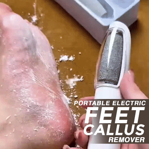 Orokuna® Portable Electric Feet Callus Remover