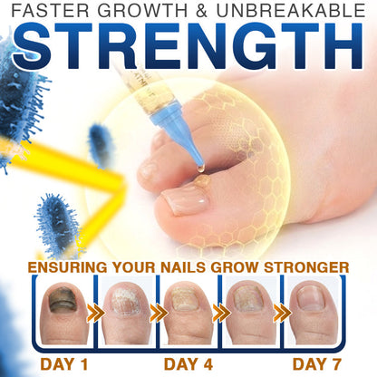 🇦🇺 CareBreeze® Fungi Free Bee Venom Nail Treatment 🩺