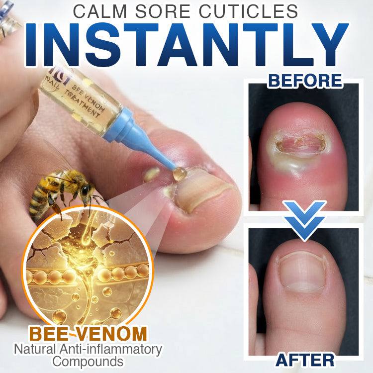 🇦🇺 CareBreeze® Fungi Free Bee Venom Nail Treatment 🩺