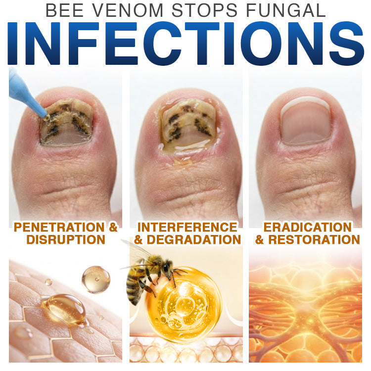 🇦🇺 CareBreeze® Fungi Free Bee Venom Nail Treatment 🩺