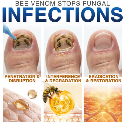 🇦🇺 CareBreeze® Fungi Free Bee Venom Nail Treatment 🩺