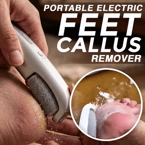 Orokuna® Portable Electric Feet Callus Remover